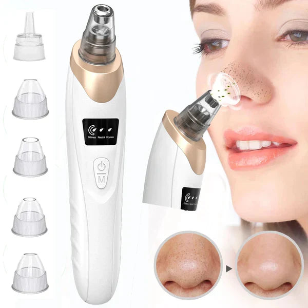 ELECTRIC BLACKHEAD REMOVER PORE VACUUM SUCCTION MACHINE